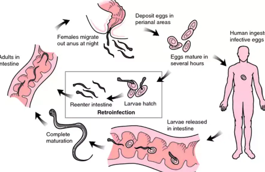 Life Cycle of Enterobiasis
