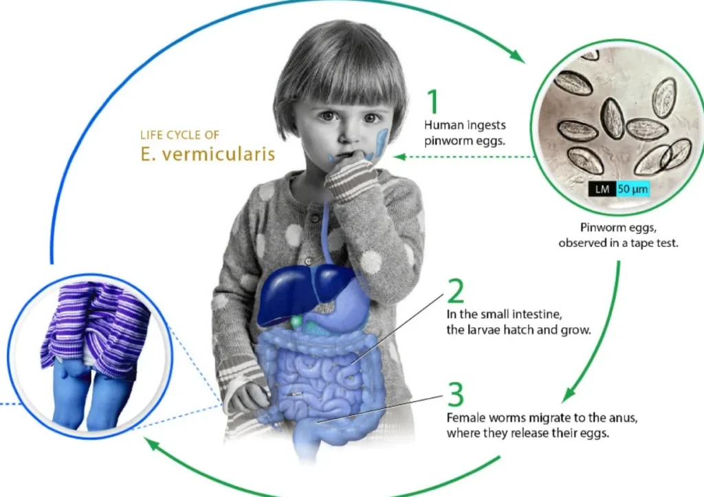 Life Cycle of Enterobiasis